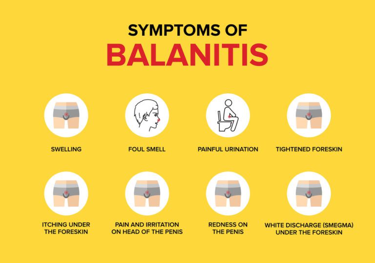 Balanitis Treatment - Dr. PK Gupta